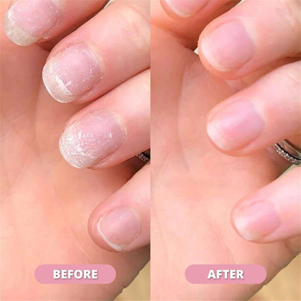 Nail Growth & Cuticle Oil Pen – Radiant Serum